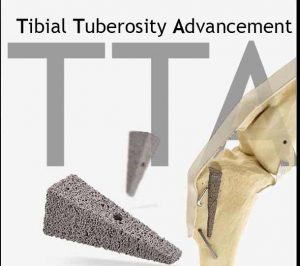 TTA-solo TTA Tibial Tuberosity Advancement